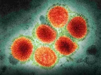 Another human case of influenza A H3N8 detected in Chinas Guangdong province