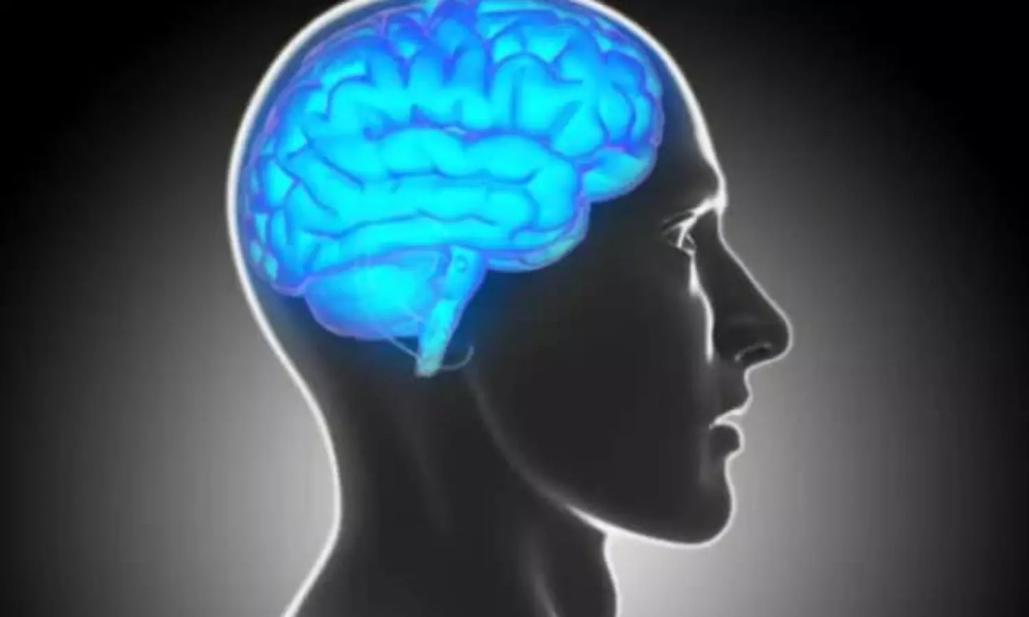 Increased brain activity found in the human brain right before death: report