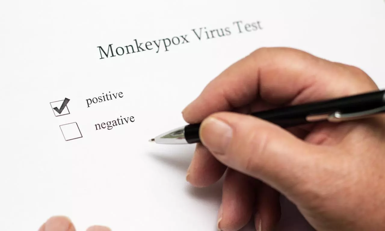 South Korea reports first possible community transmission of mpox South Korea reports first possible community transmission of mpox