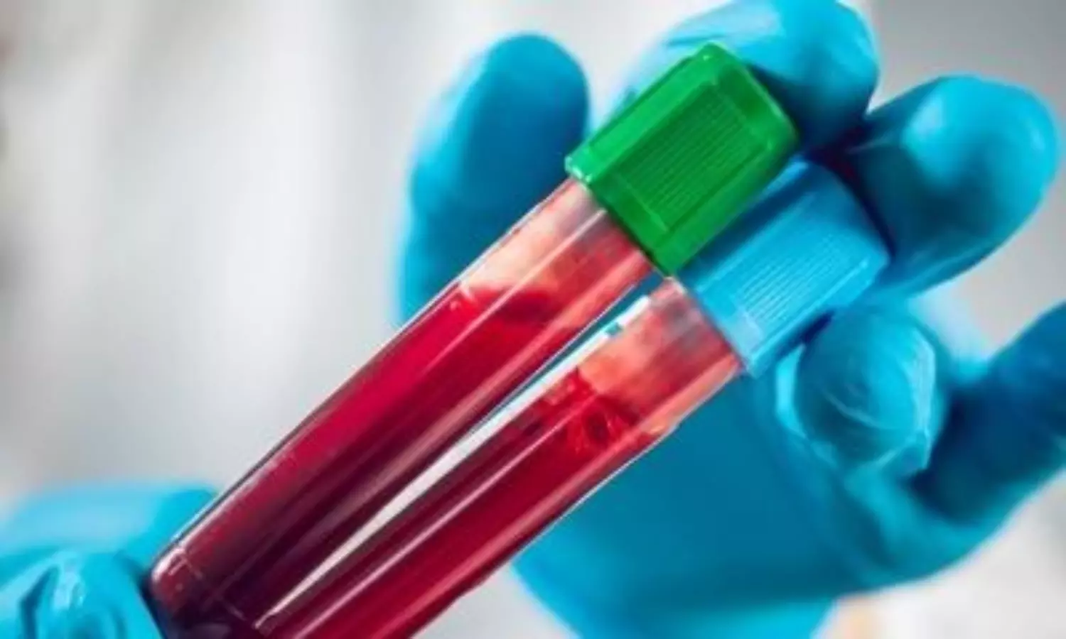 Indian startup develops blood test to detect 32 cancers in men, women