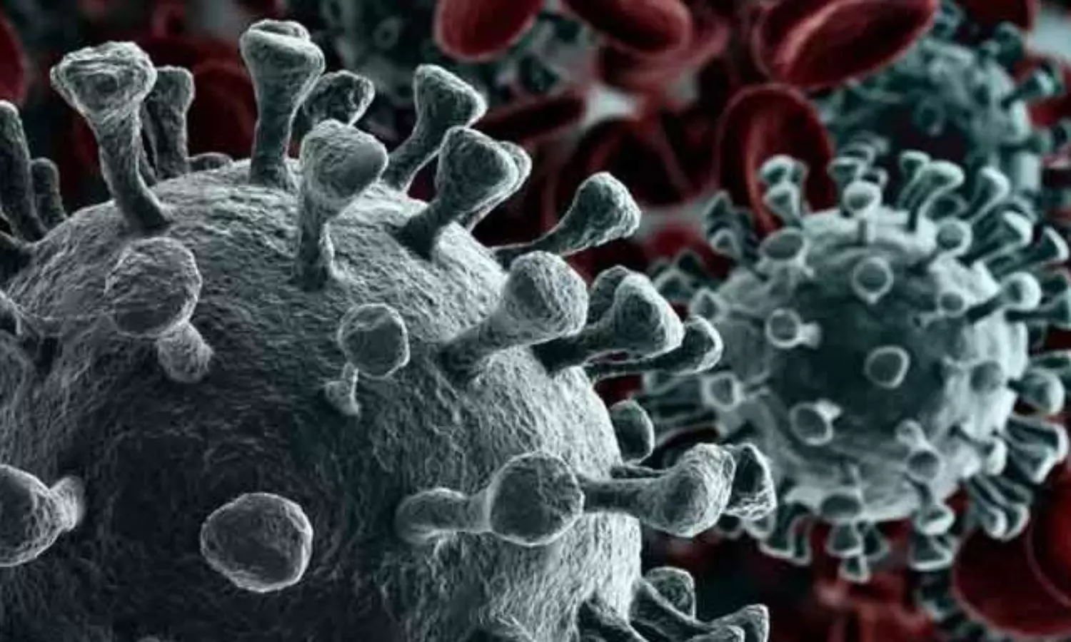 Experts fear long Covid may be undercounted, misdiagnosed in children