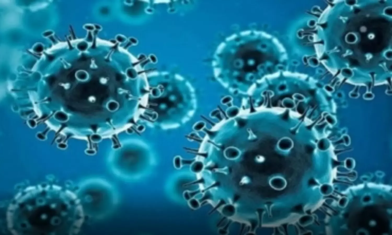 Covid fatalities due to bacterial pneumonia rather than cytokine storm: study