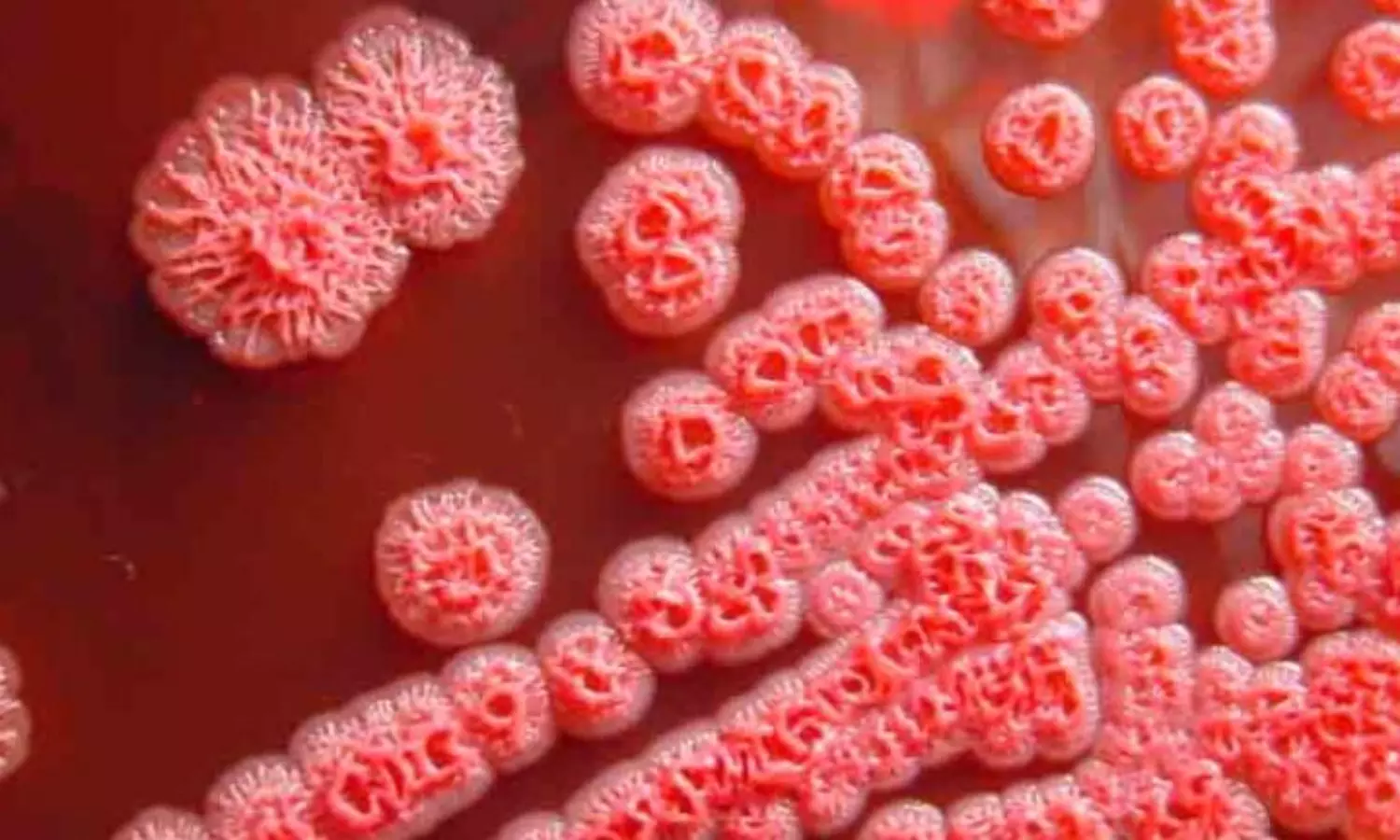 US authorities monitoring a dangerous bacteria found in Gulf Coast