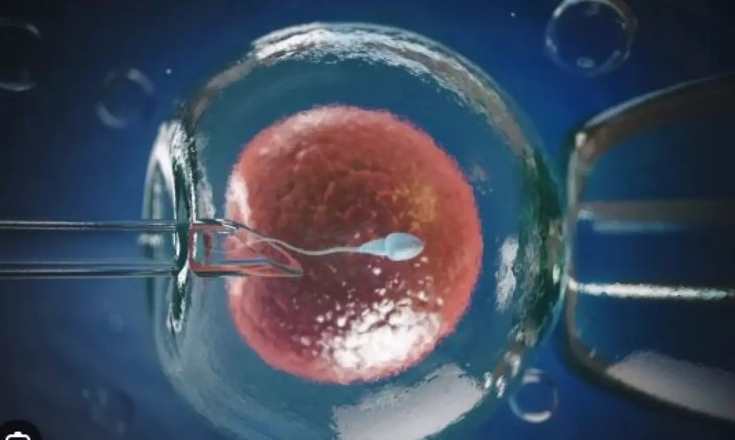 For the first time in India, a woman prisoner seeks nod for IVF but court says it may affect trial