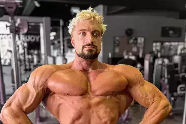 German fitness star Jo Lindner dies at age 30 of ‘ aneurysm’