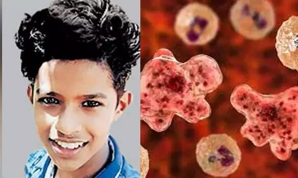 Rare ‘brain-eating amoeba’ takes life of a 15-year-old boy in Kerala