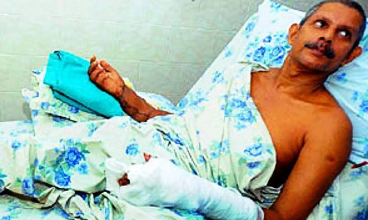 Prof Joseph’s hand chopping case: NIA court drops UAPA charges against accused