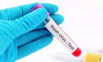 Nipah virus