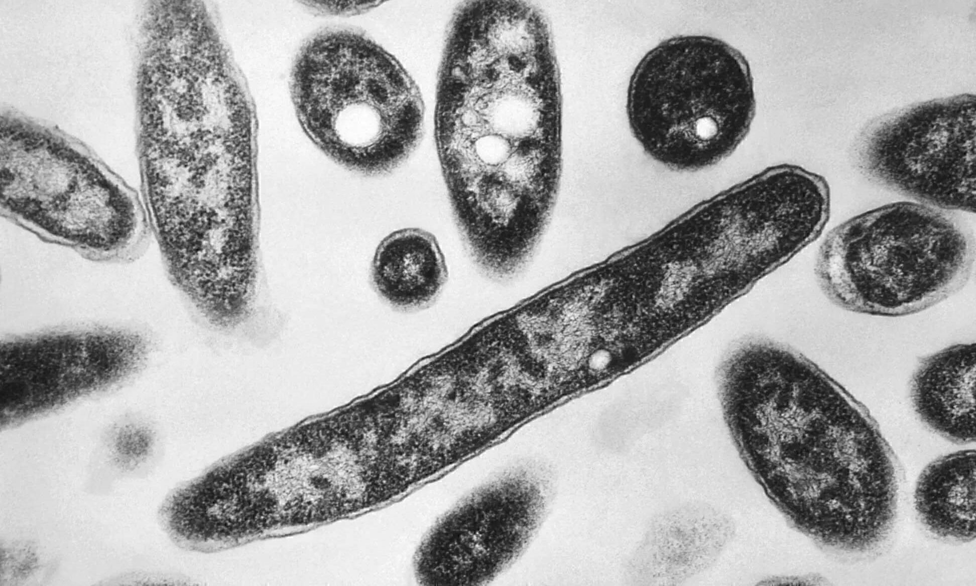 Health expert warns pandemic caused by Disease X could kill 50 mn people