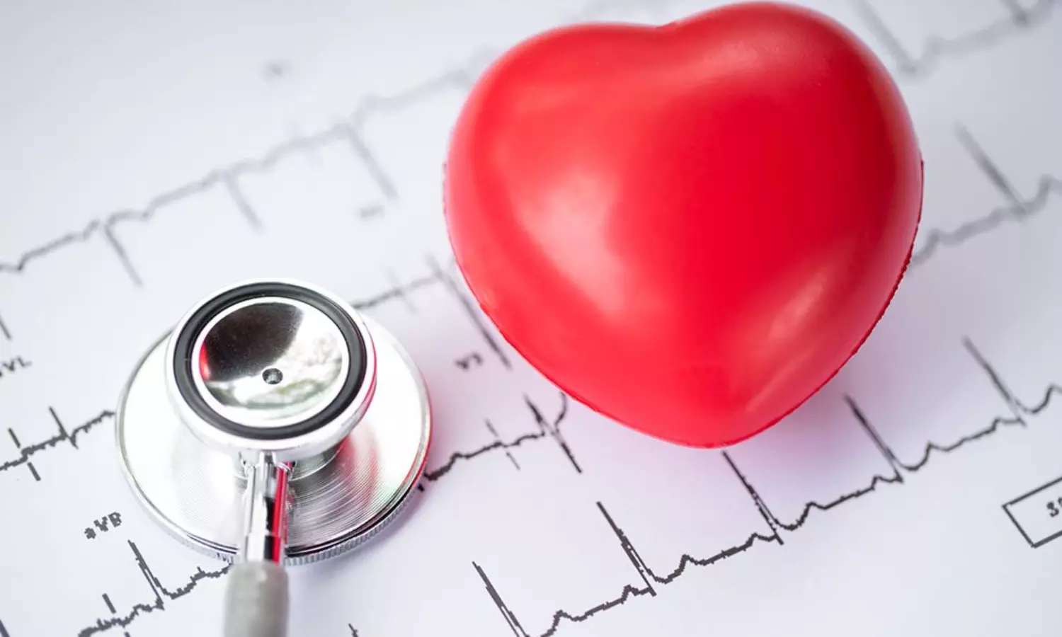Climbing 50 steps a day reduces heart disease risk by 20%: Study