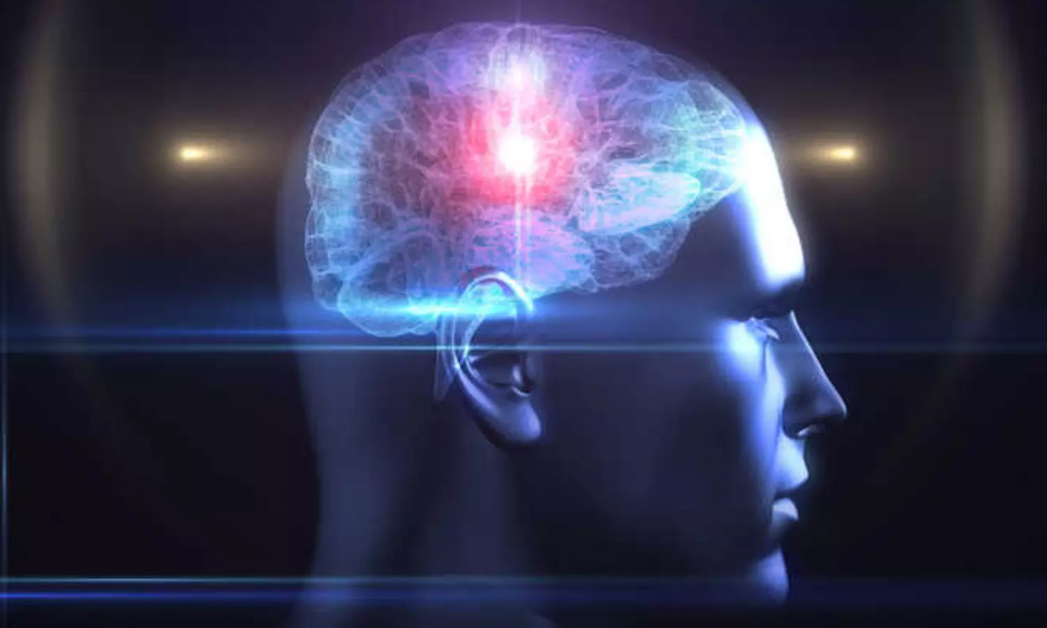 Dementia three times more likely in adults with ADHD
