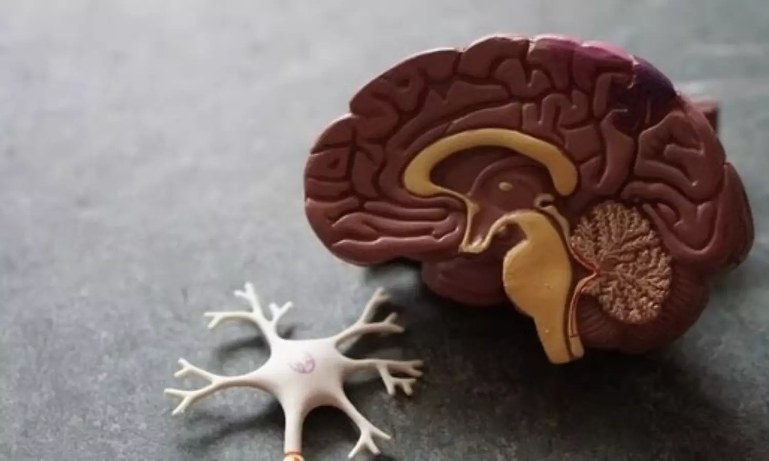 Study links Alzheimers, gut microbes; may lead to early detections