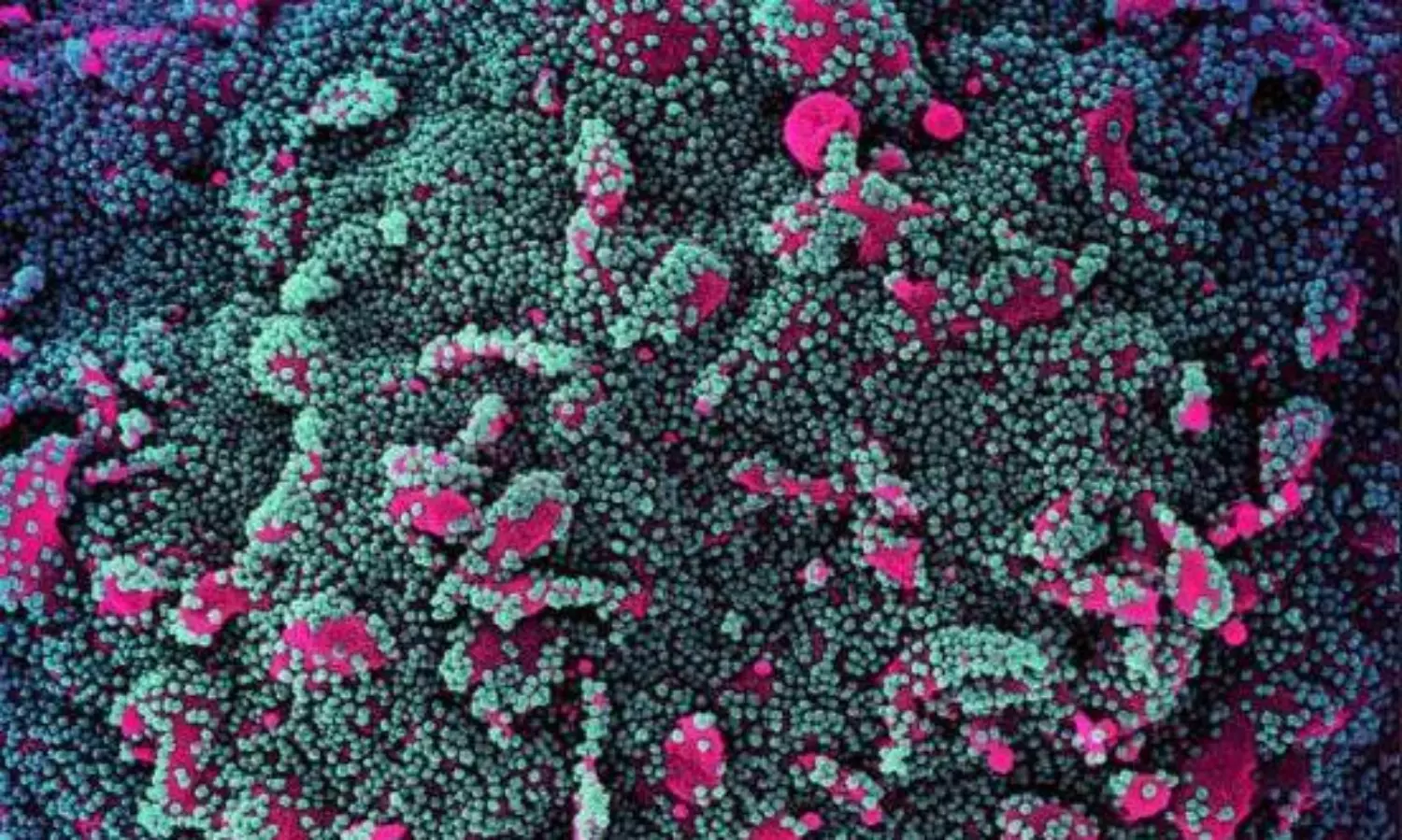 JN.1 Covid variant: cases rise steadily in the India