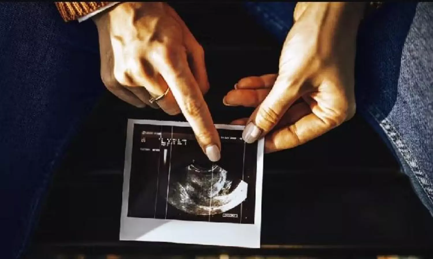 In-take of this drug during pregnancy raises risk of miscarriage