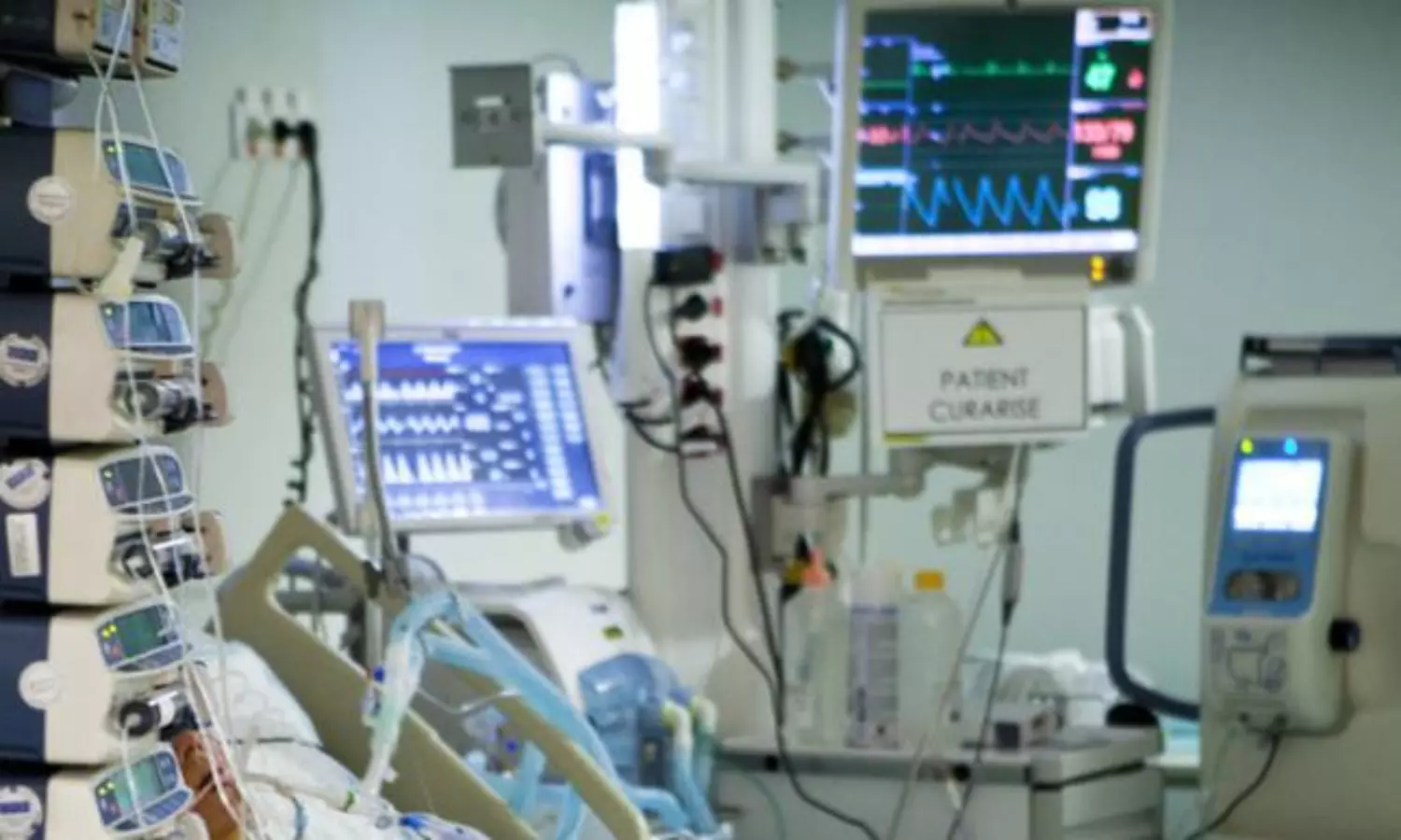 Rare disease; 5-member Kerala family to appeal SC for mercy killing