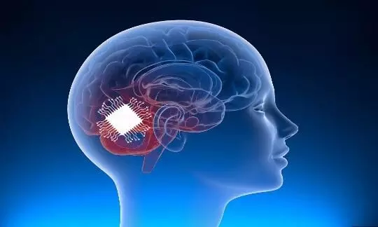 Neuralink implanted first brain chip in a human: Elon Musk claims