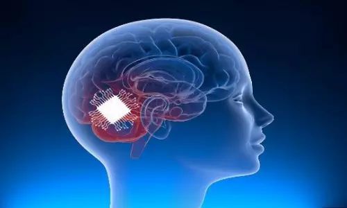 neuralink