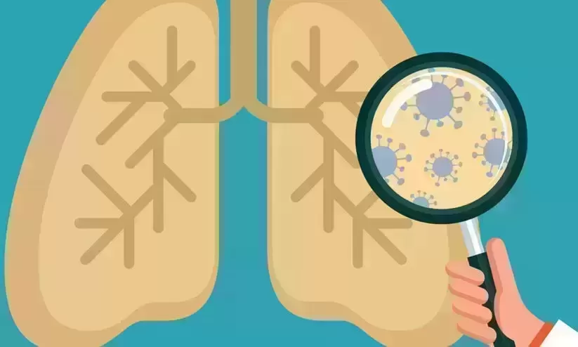 Kerala wins Centres award for TB prevention activities