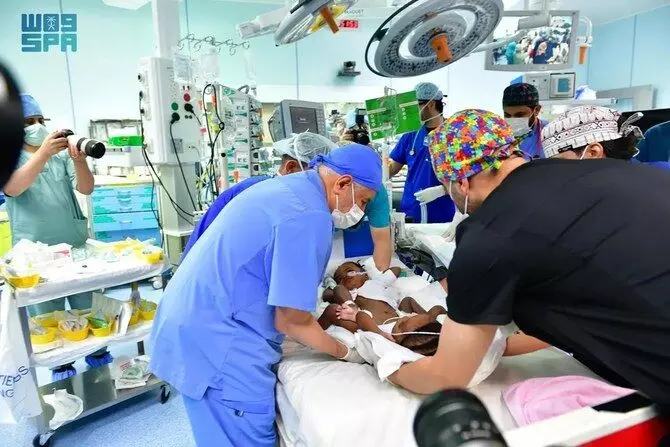 Saudi medical team triumphs in separating Nigerian conjoined twins