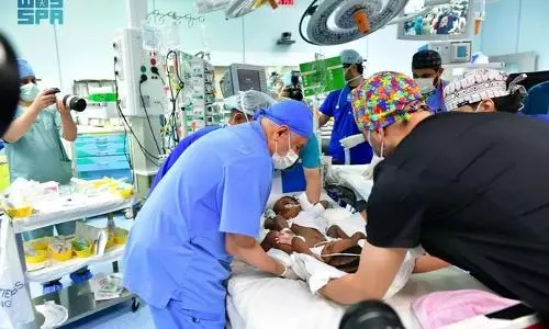 Saudi medical team triumphs in separating Nigerian conjoined twins
