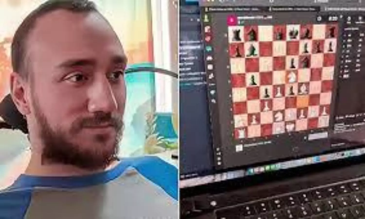 Man with Neuralink brain chip uses platform X ‘ by just thinking’