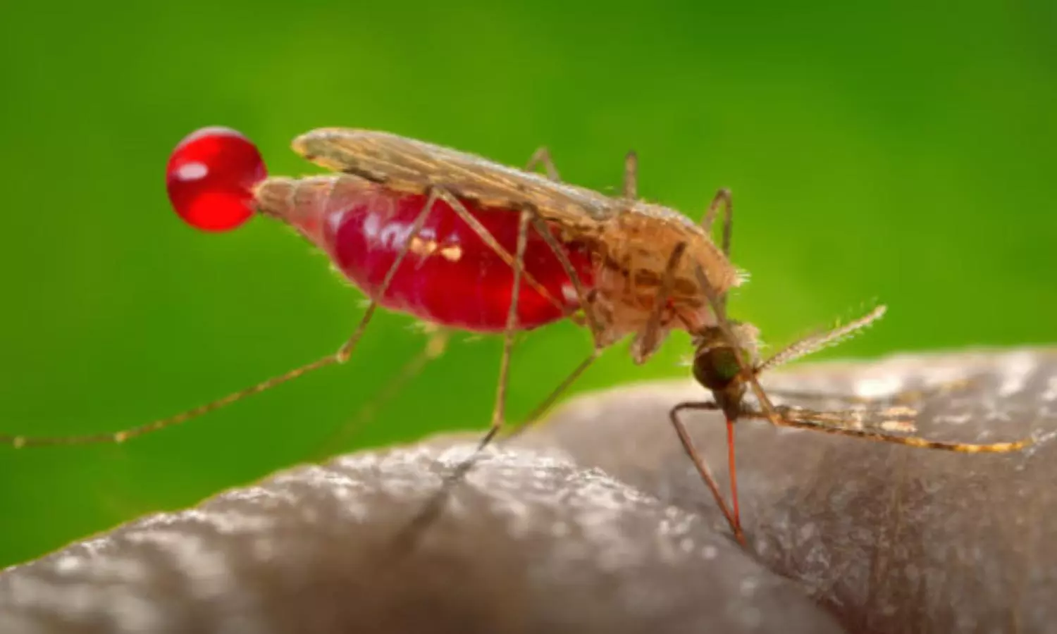 UAE Embassy alerts citizens to cholera and malaria risk in Comoros