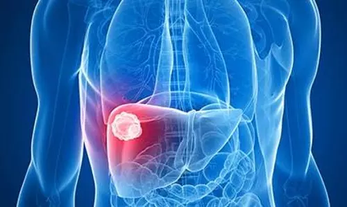 Kerala, Maha, Goa, Guj new hotspots of fatal liver cancers: study