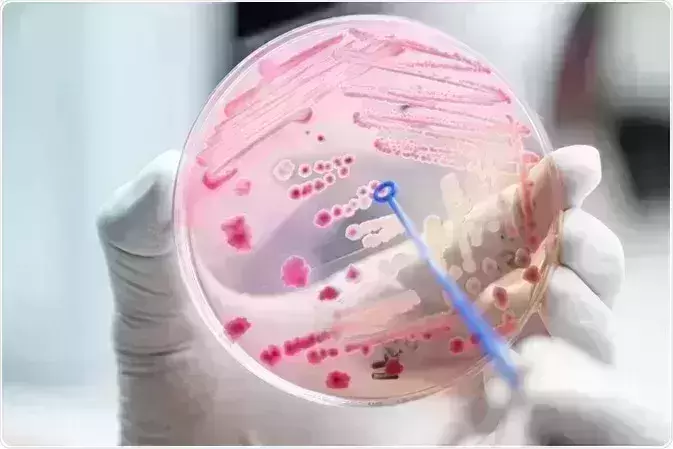 Antimicrobial resistance threat remains as major health concern globally