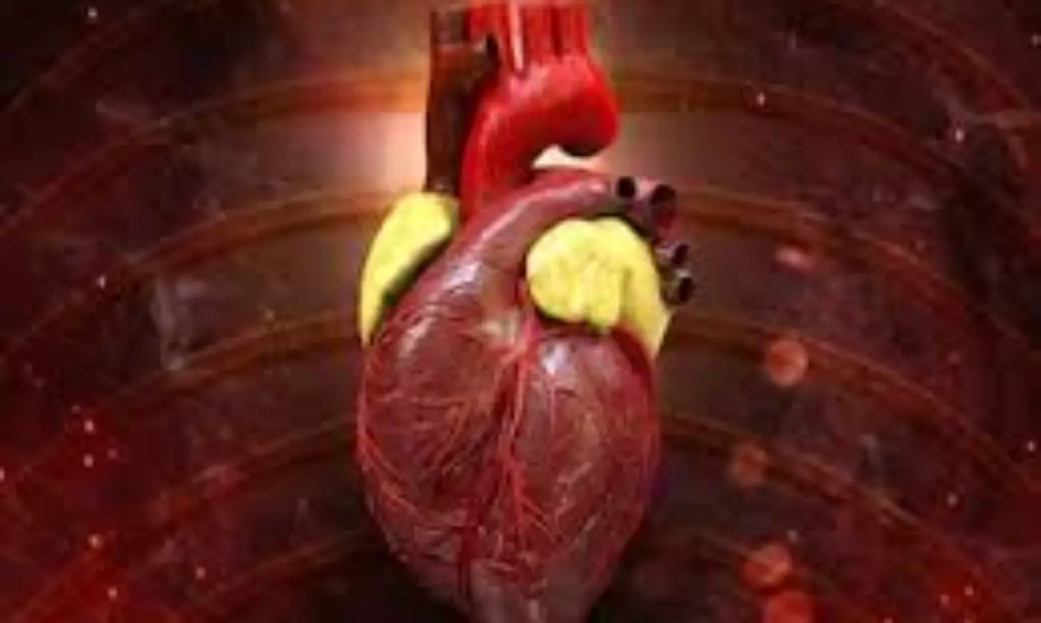 Asymptomatic heart condition leads to sudden cardiac arrest: experts