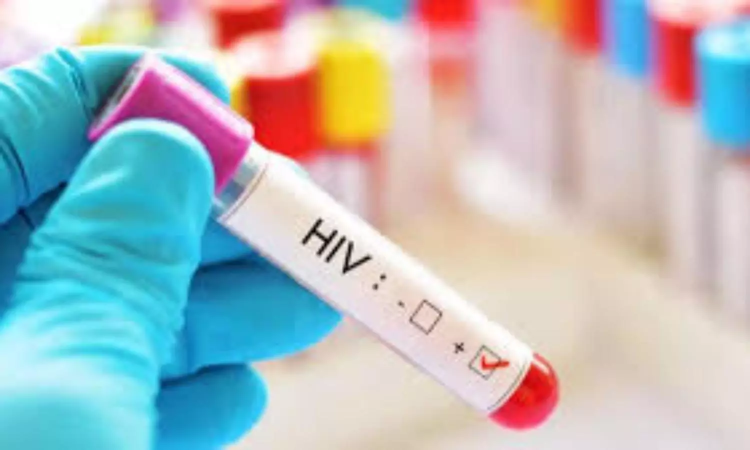 Alarming HIV crisis emerges in Tripura as 828 students affected