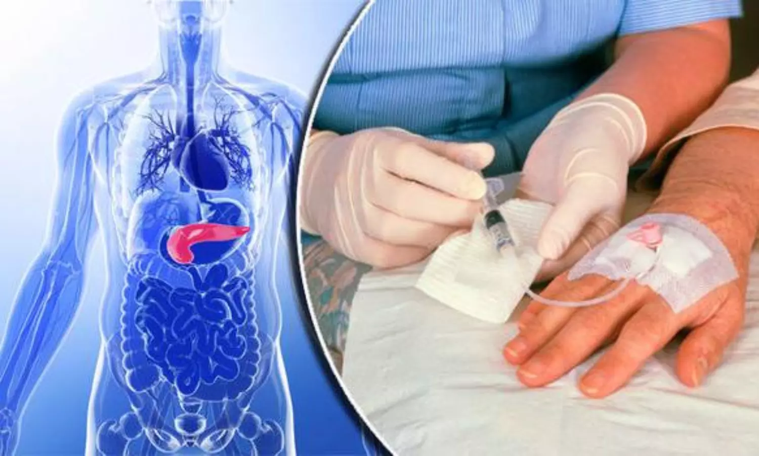 Ground-breaking DNA discovery offers hope for pancreatic cancer treatment