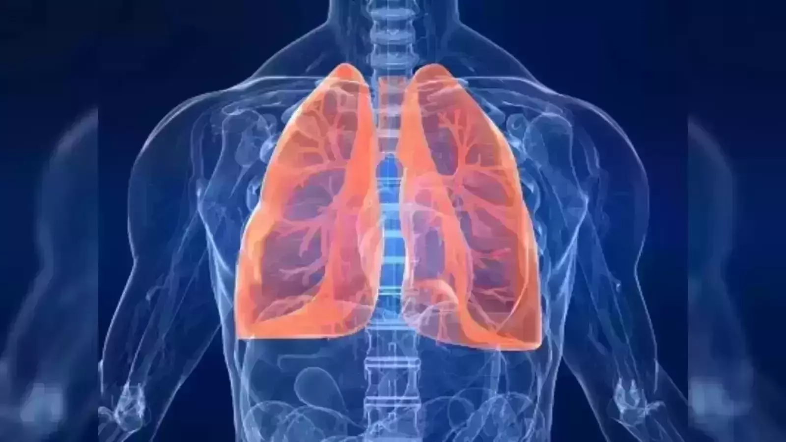 Indian doctors warn of higher lung disease burden than projected