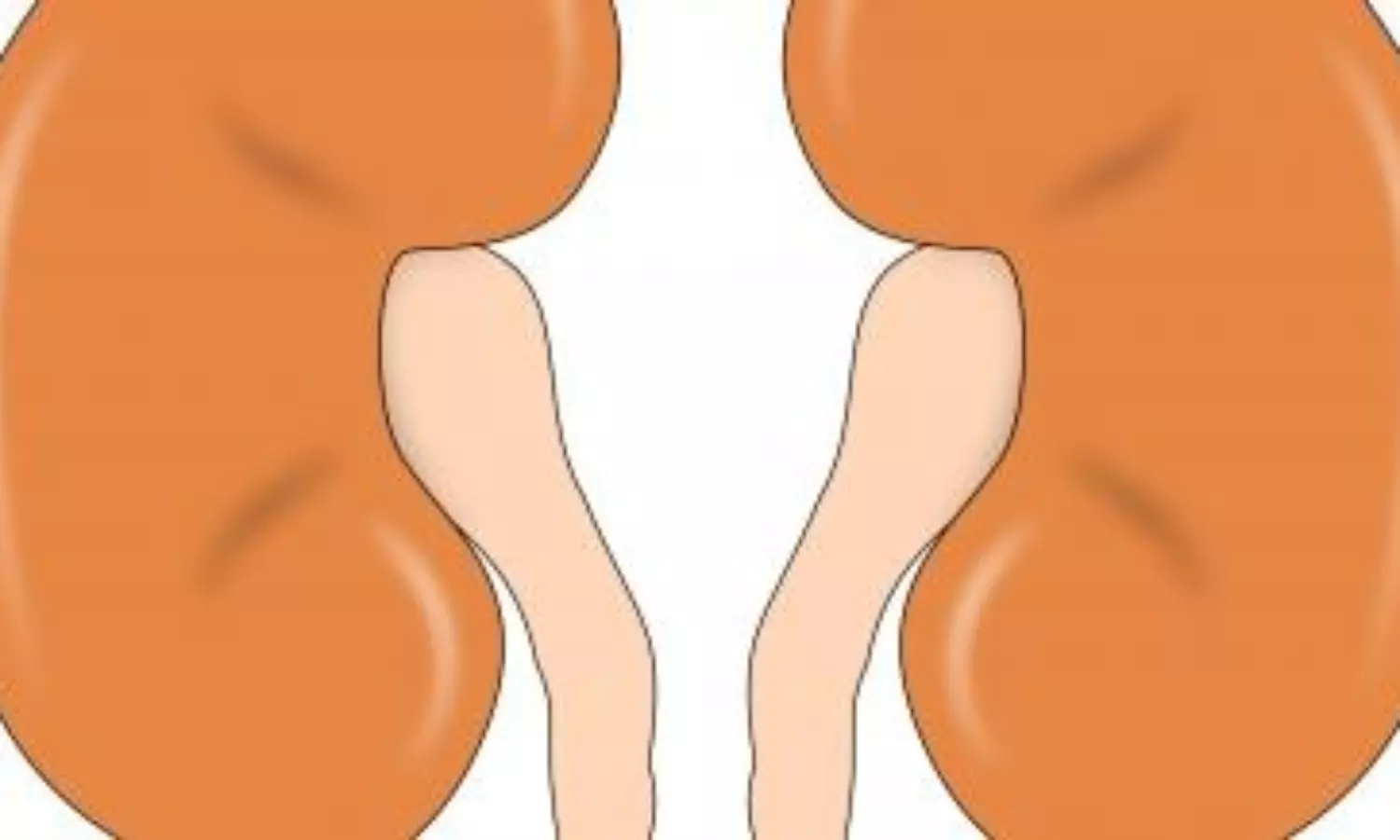 Mortality risk in kidney disease patients may be lowered by protein-rich diet