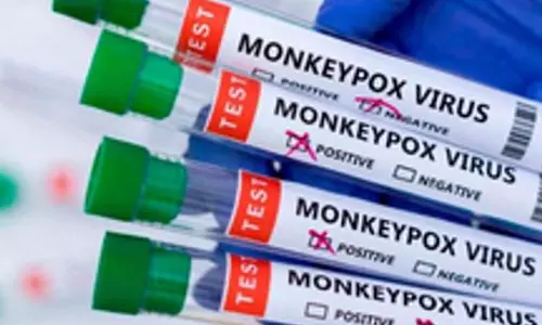 Patients condition stable as India reports suspected Mpox case: Govt