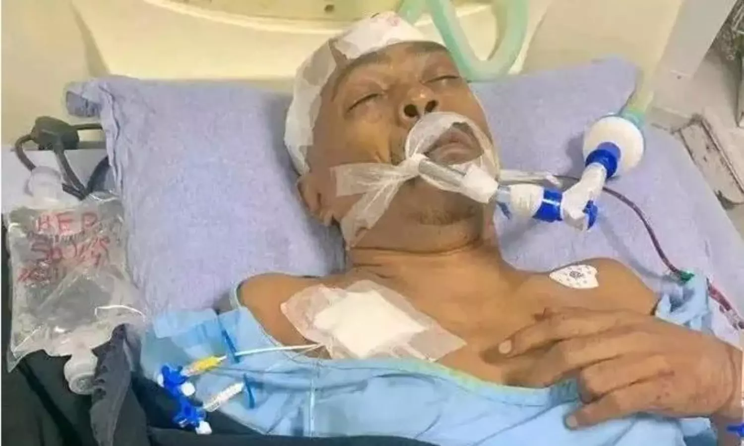 Bangladesh Hindu priest Chinmoy Krishna Das’ advocate attacked: ISKCON