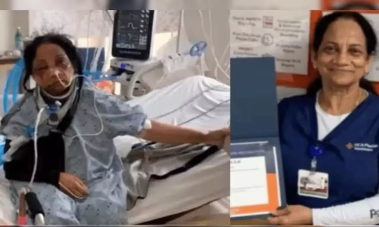 US man attacks Indian-origin nurse, breaks almost ‘every bone in face’