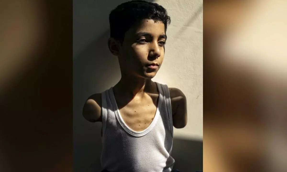 Photo of armless Gaza boy injured in Israeli strike wins World Press Photo of the Year