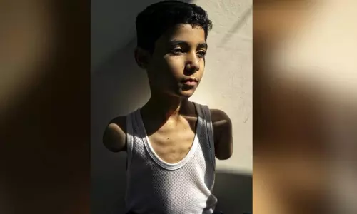 Photo of armless Gaza boy injured in Israeli strike wins World Press Photo of the Year