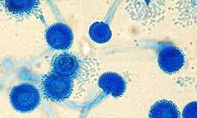 deadly fungus Aspergillus fumigatus