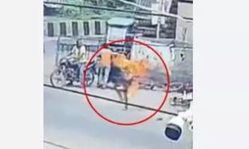 Miscreants set lottery seller on fire in West Bengals Midnapore