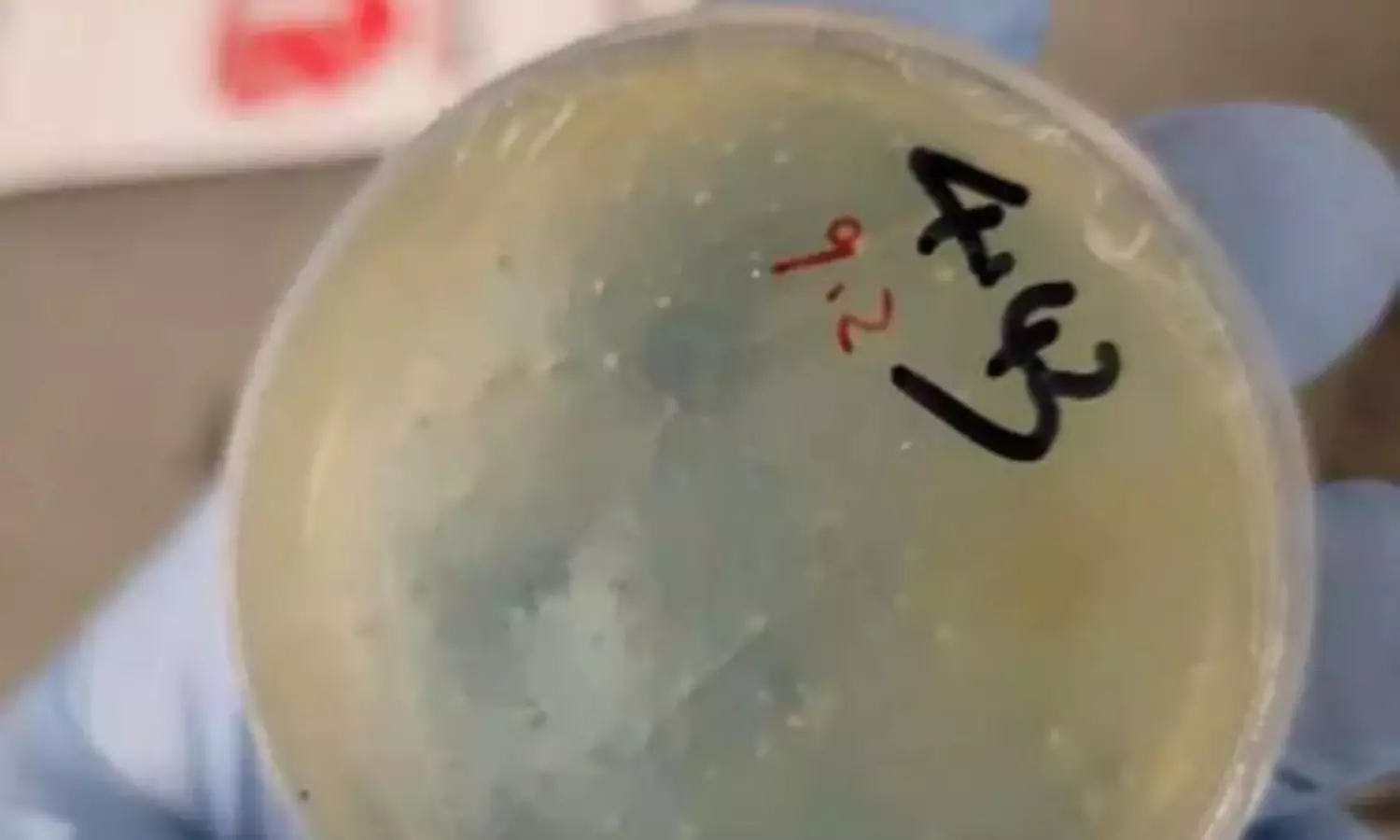 Smuggling roundworms into University of Michigan lab; FBI arrests Chinese researcher