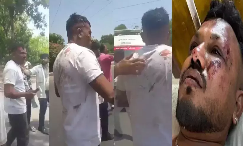 Gujarat plane crash: 1 passenger miraculously escapes!!