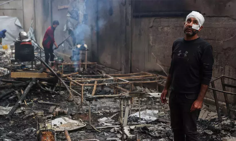 Israel kills 51 Gazans in a day, targets tents of displaced people!