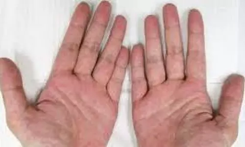 hands