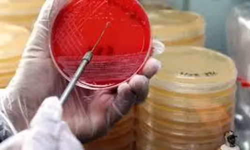 typhoid
