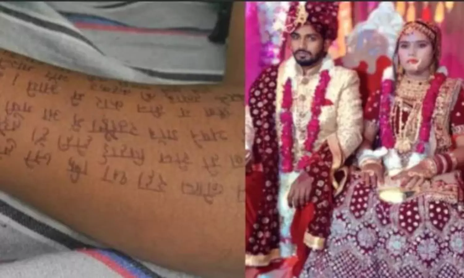 UP woman dies by suicide writing suicide note on arm, leg, stomach