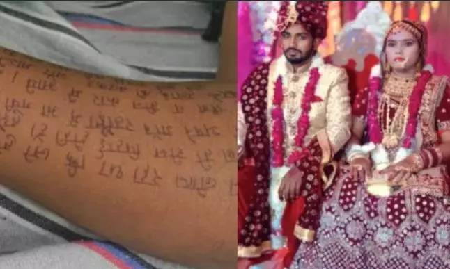 UP woman dies by suicide writing suicide note on arm, leg, stomach