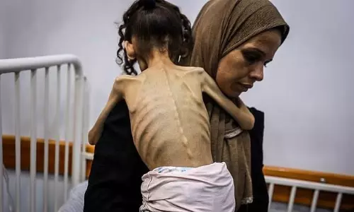 UK to evacuate Gaza children; Israeli veterans urge end to war, Democrats back Palestinian state