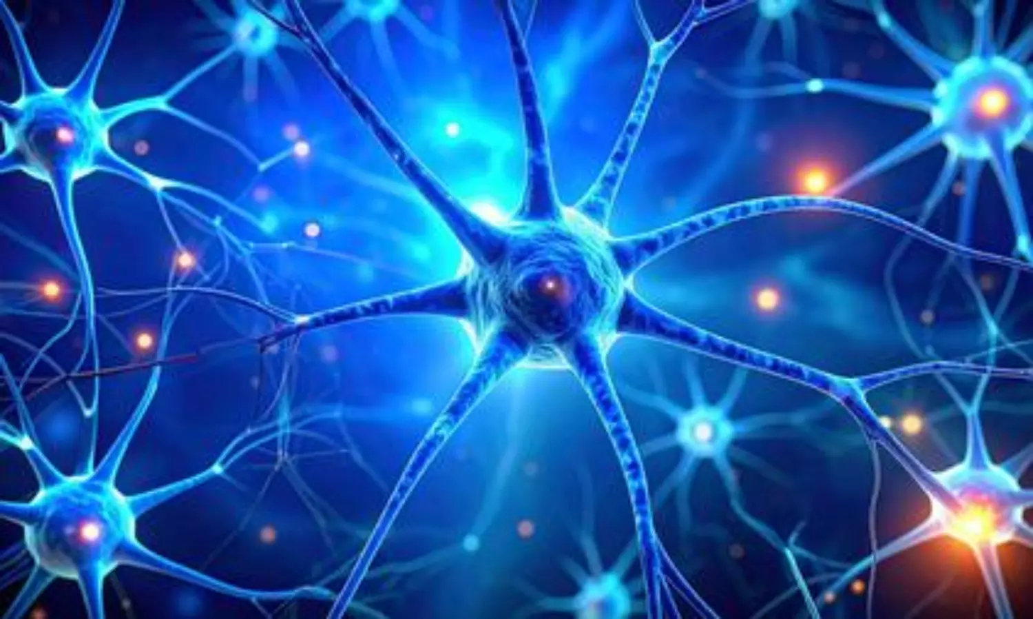 Overworked brain cells may burn out in Parkinson’s disease: Study