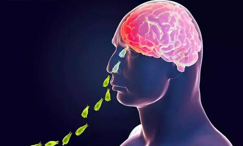 Amoebic Meningoencephalitis: 2 more die in Kerala